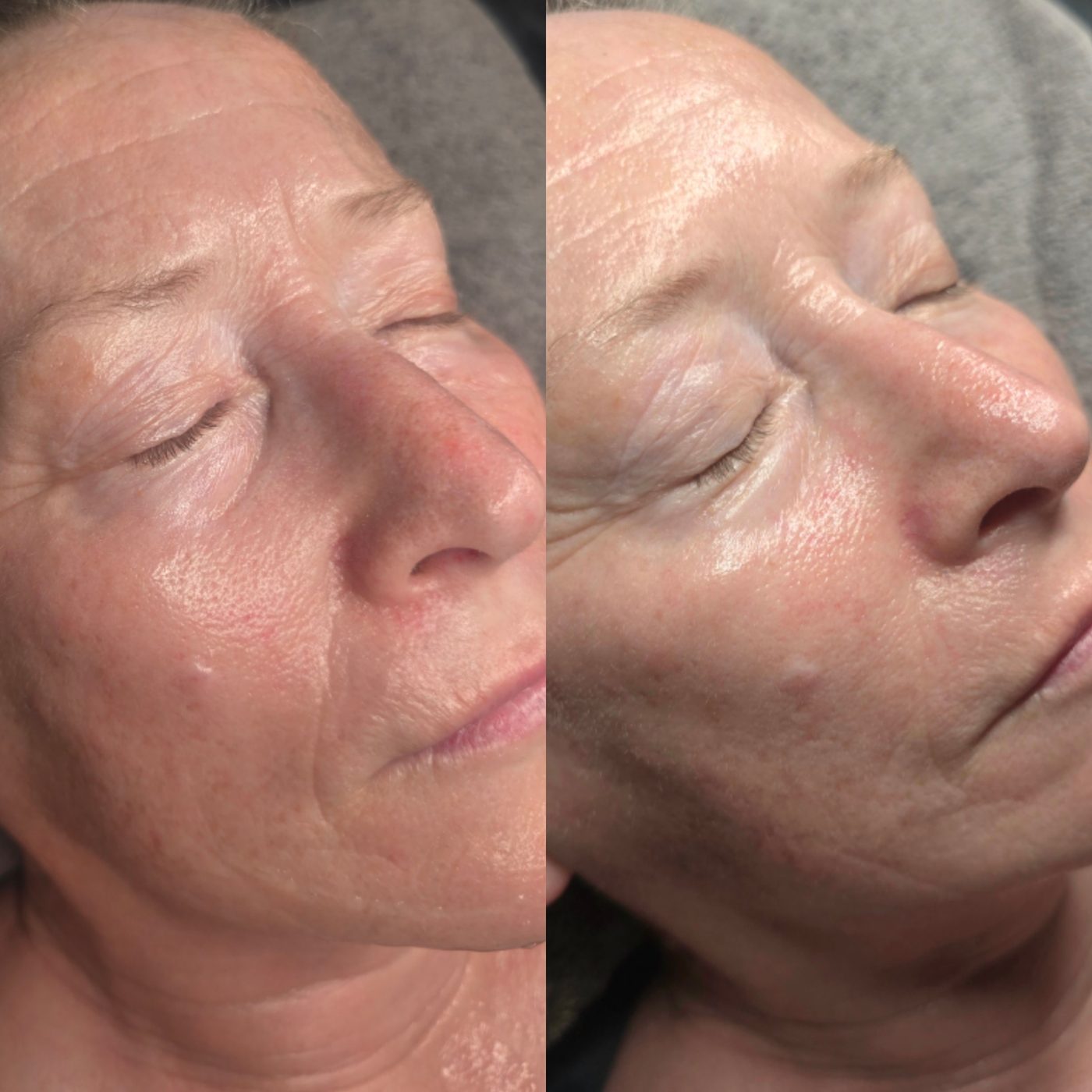 Before and after: brighter skin with smoother texture and tone